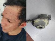 Lelaki melecur di muka akibat kebakaran kepala gas dapur