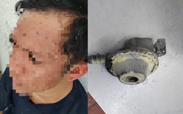 Lelaki melecur di muka akibat kebakaran kepala gas dapur